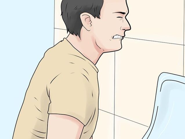 Sāpīga urinēšana ir prostatīta saasināšanās simptoms vīriešiem