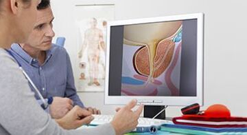 prostatīta diagnosticēšana vīriešiem